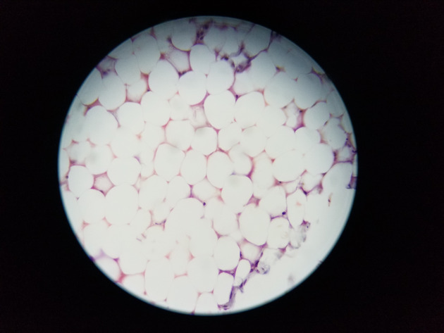 Adipose Connective Slides - Adipose Connective 08 400X